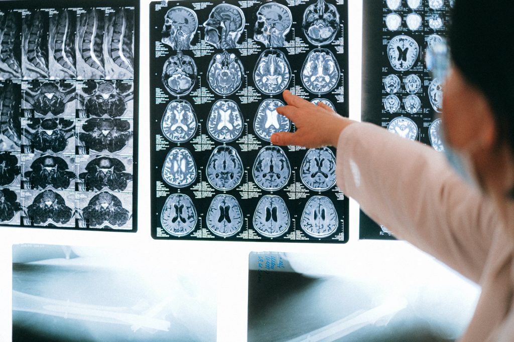 Clinician reviewing brain MRI scans