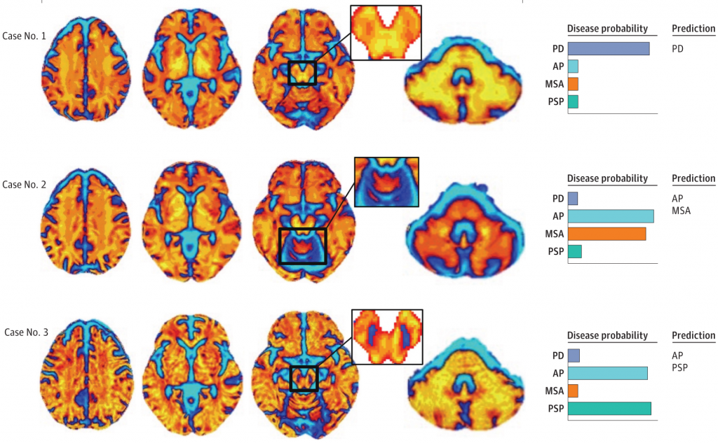 Scientific image showing brain analysis